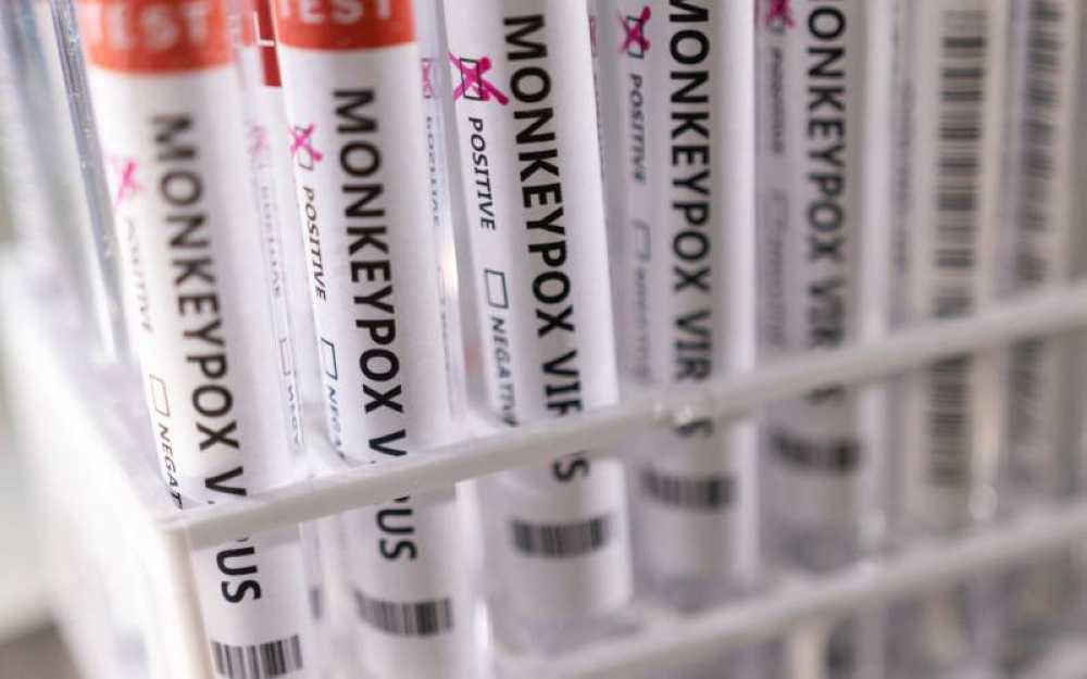 Colombia's confirmed monkeypox cases rise to 273