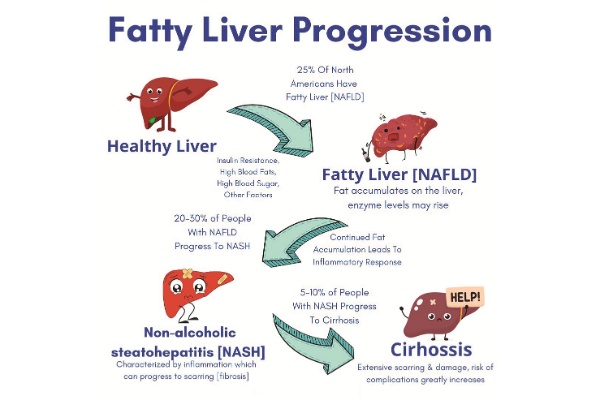 Enzyme’s Role In Nafld