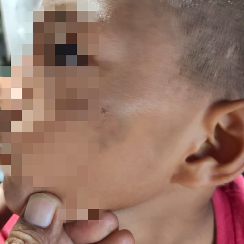 Image from: ‘Anak saya ditumbuk, kepala ditekan pada tangga’