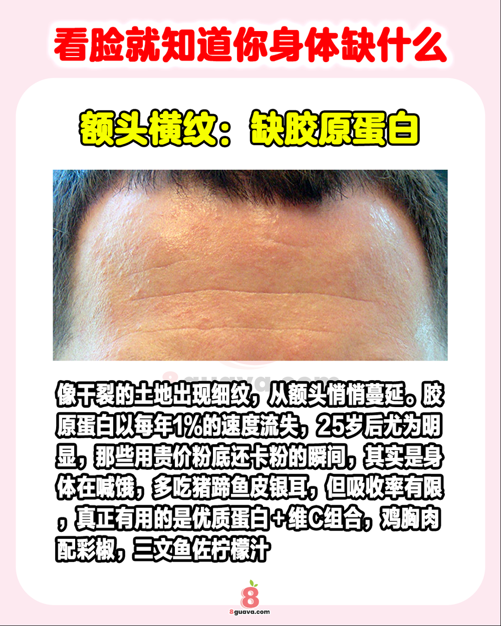 Image from: 看脸就知道你身体缺什么 ✨快来看看你中招了吗❓