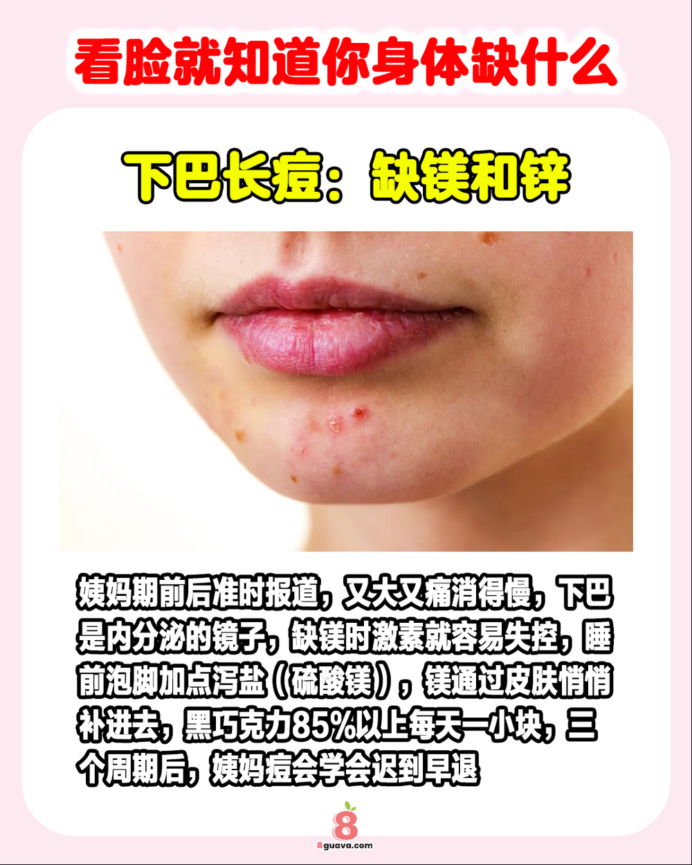 Image from: 看脸就知道你身体缺什么 ✨快来看看你中招了吗❓