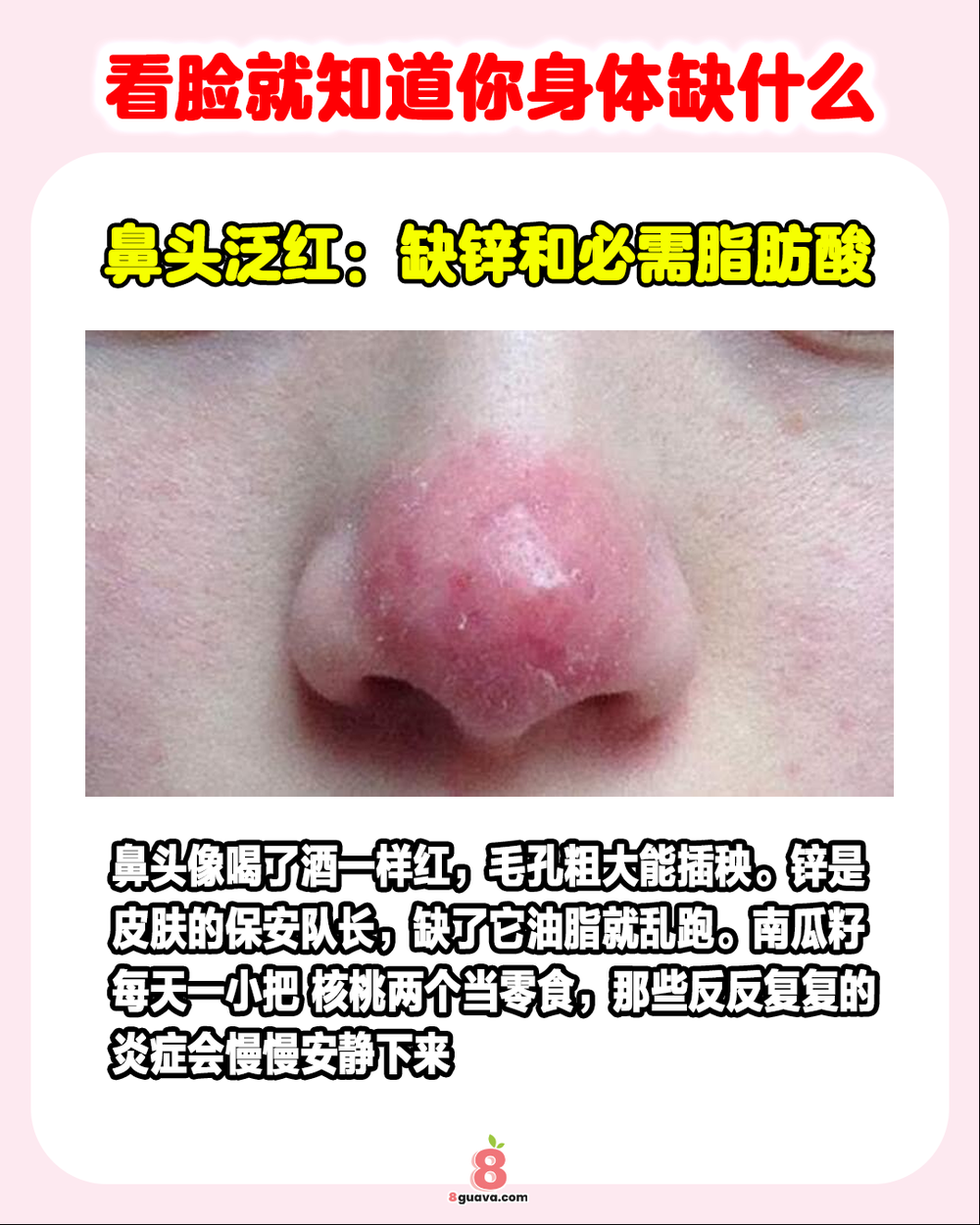 Image from: 看脸就知道你身体缺什么 ✨快来看看你中招了吗❓