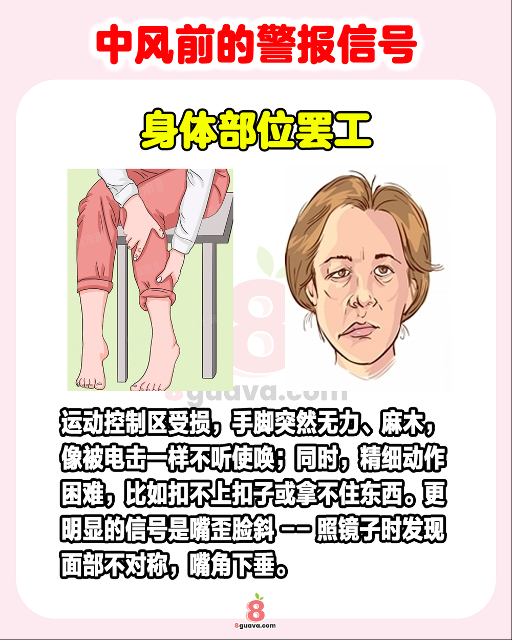 中风前的警报信号