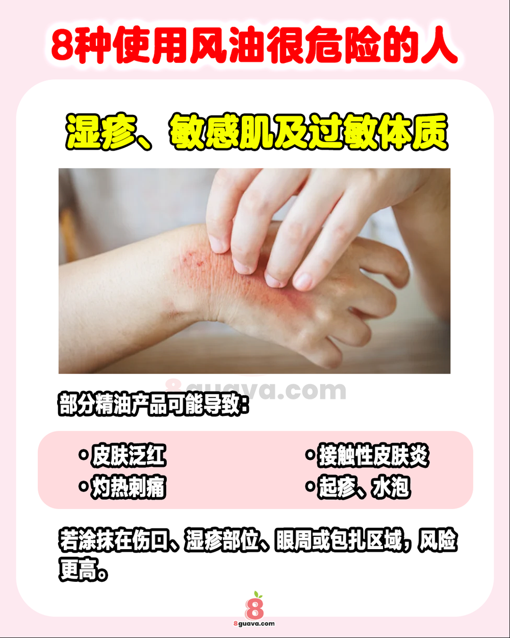 Image from: 8种使用风油很危险的人 ✨原来风油精不是人人都能抹❗
