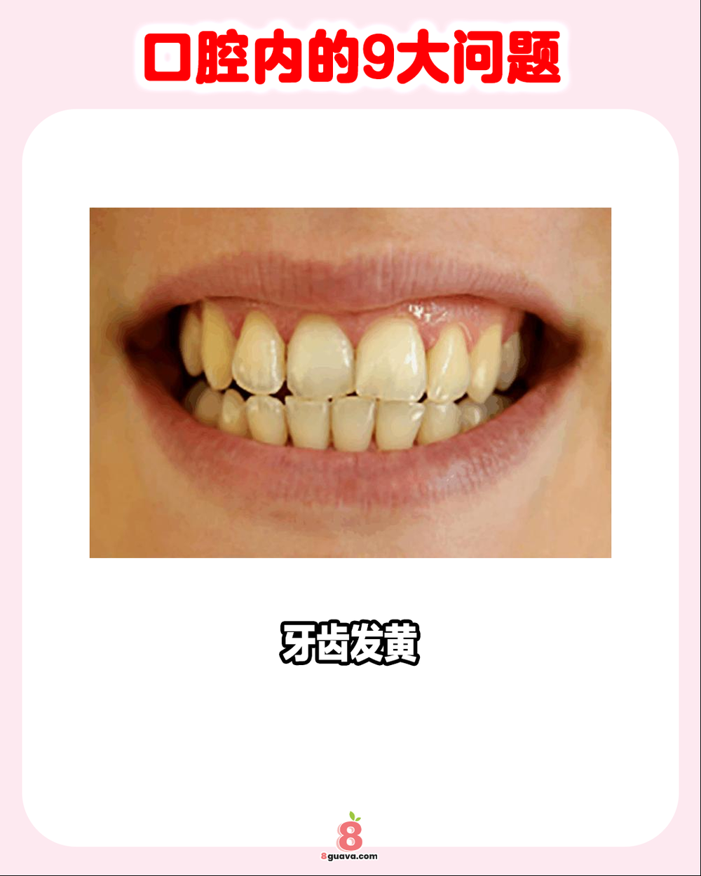 口腔内的9大问题