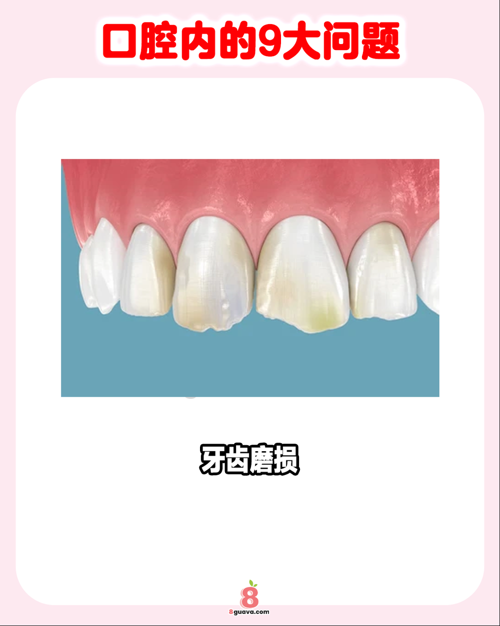 Image from: 口腔内的9大问题 一次看 护齿必看！🦷🪥