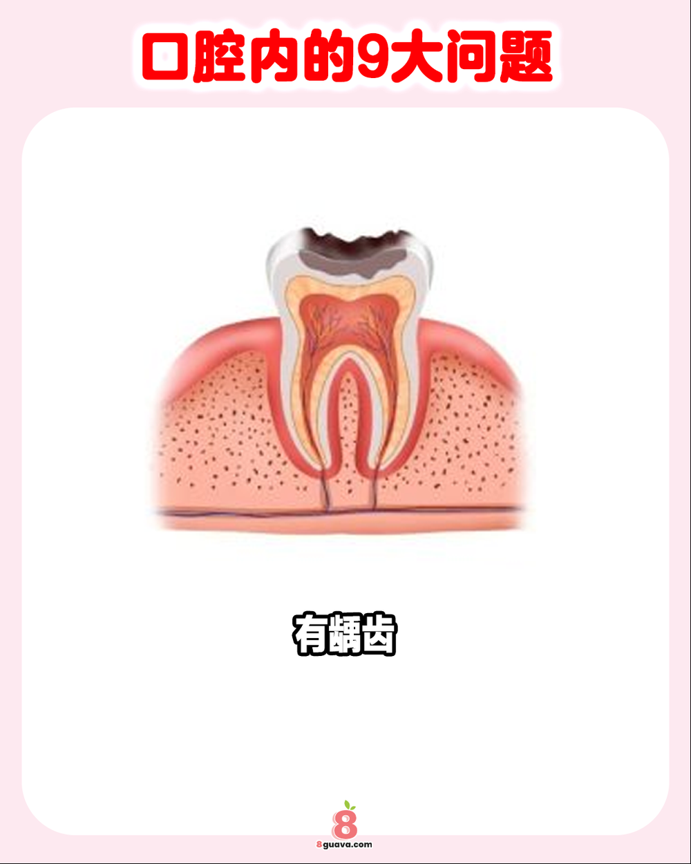口腔内的9大问题
