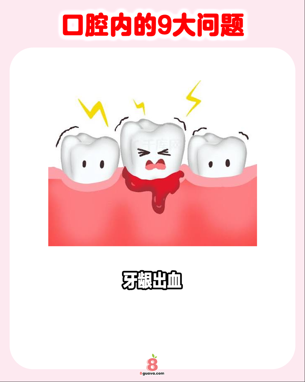 口腔内的9大问题