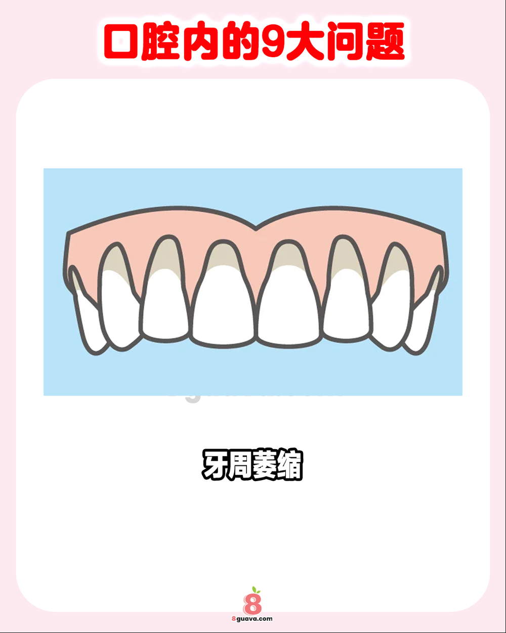 Image from: 口腔内的9大问题 一次看 护齿必看！🦷🪥
