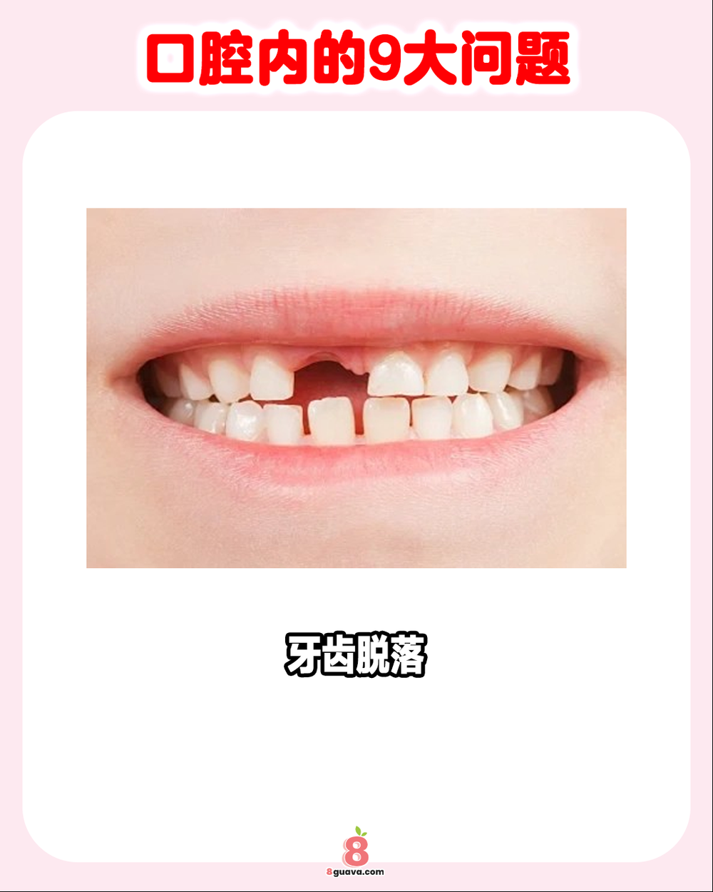 口腔内的9大问题