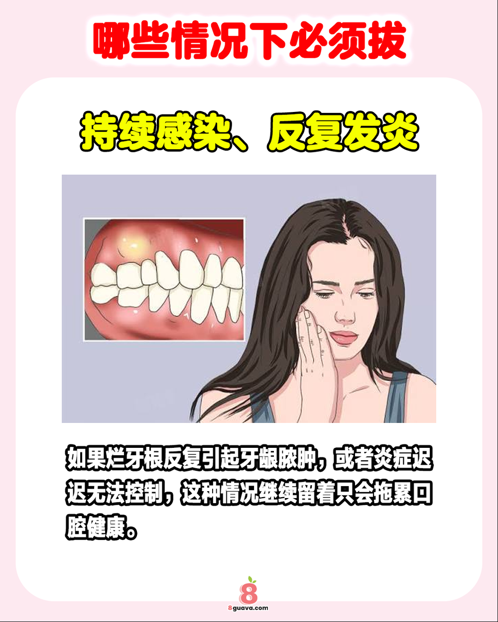 Image from: 烂牙根不拔的风险 一次看🦷这些情况下必须要拔❗