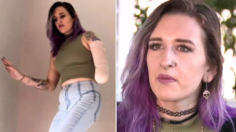 South Carolina woman's hand amputated after burning it in freak