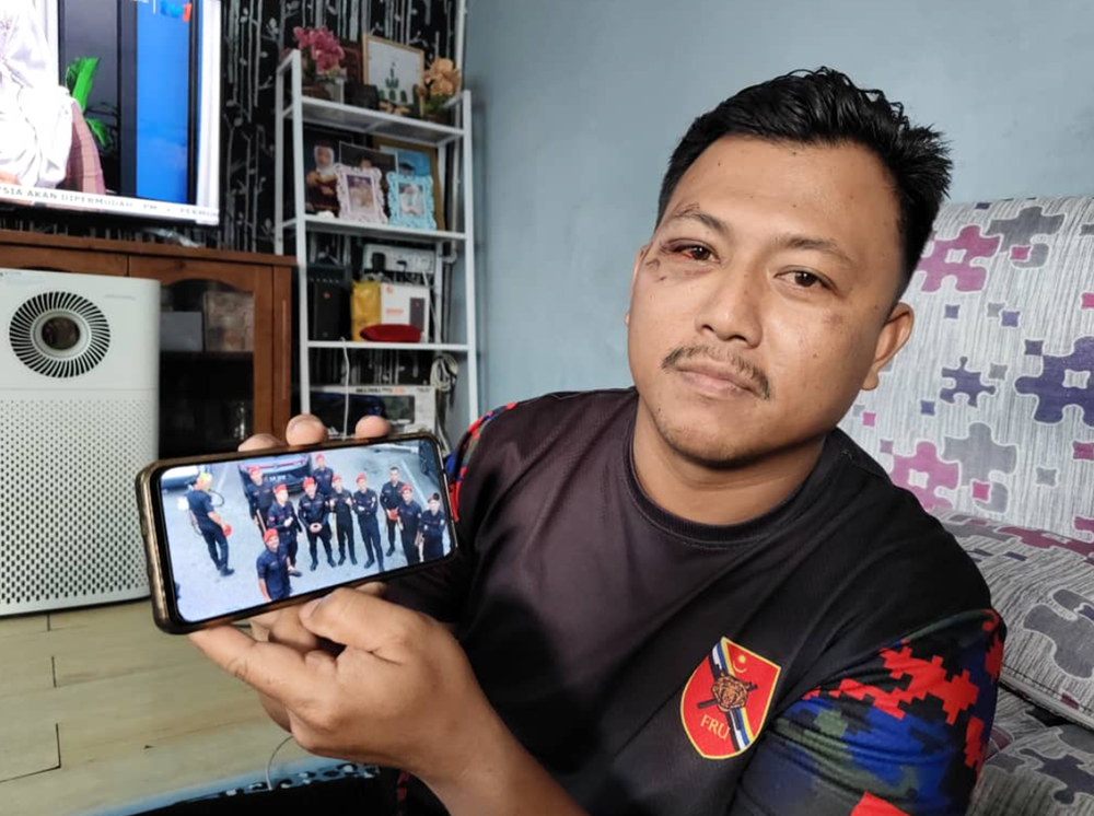 Image from: “Kami Bertindih-Tindih, Rakan-Rakan Longlai Tak Bersuara” – Koperal Kongsi Detik Selepas Nahas FRU