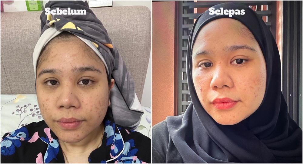 Image from: Penangan Love Pattranite Buat Sunway Pyramid “Shut Down” Seketika. Peminat Serbu Acara Eucerin Dermopure Clinical