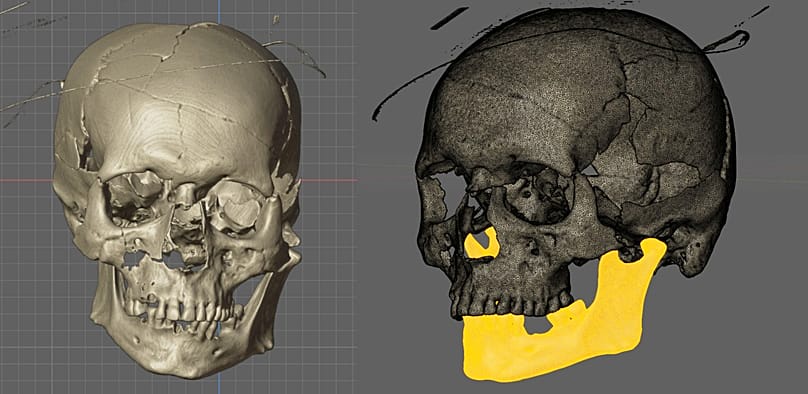 Skull of supposed vampire found in Croatia 2023