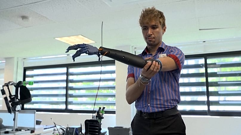 Alberto Orozco, meromelia patient and E-Redi first user, wearing and testing robotic arm