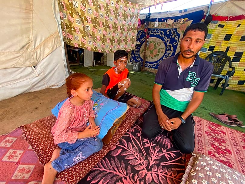 Palestinian displaced man Hamada Abu Ghali with his child who has chickenpox, Nuseirat camp, central Gaza Strip