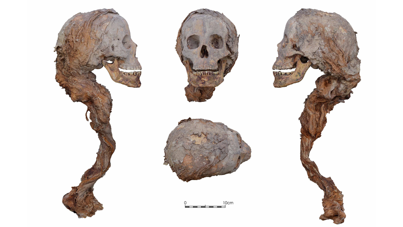 Image from: Archaeologists Found Queen Elisenda’s Remains, Then Discovered 25 Medieval Skeletons With Strange Signs of Violence