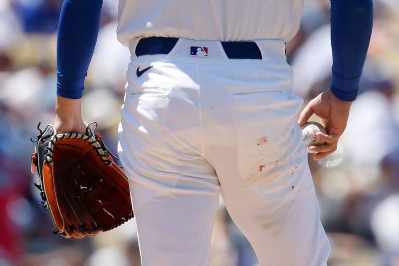 Image from: Dodgers fans spot reason for season-worst pitching performance from Shohei Ohtani against the Rays