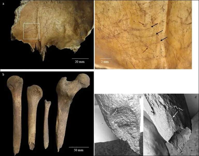 Image from: Archaeologists Thought They Had Found Ancient Tools in a 2,000-Year-Old Scottish Grave, They Turned Out to Be Human Bones