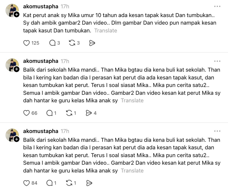 Image from: Anak Ako Mustapha dikasari 5 murid lain, dedah ada kesan tumbukan & tapak kasut