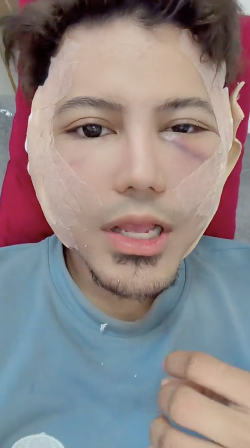 Image from: Buat pembedahan plastik? Prince Syed jawab bukan ubah cuma perbaiki kesilapan -“Kena buat”