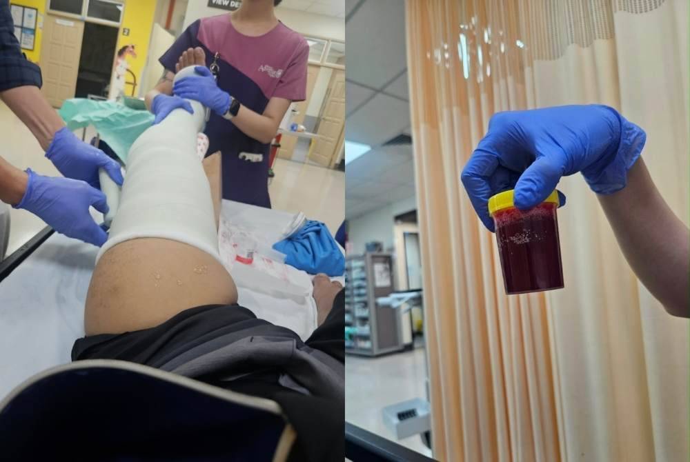 Image from: Man breaks leg after alleged impact from world's largest tipping bucket at Penang water park