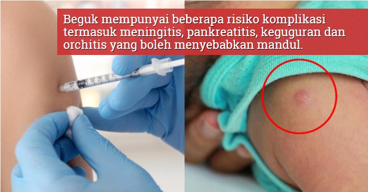 Image from: Lebih Setengah Juta Dewasa Hidap Empat Penyakit Tidak Berjangkit - Dzulkefly