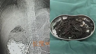 Image from: Impak Sosioekonomi Akibat Kemalangan Jalan Raya Cecah RM30 Bilion Setahun - Nanta