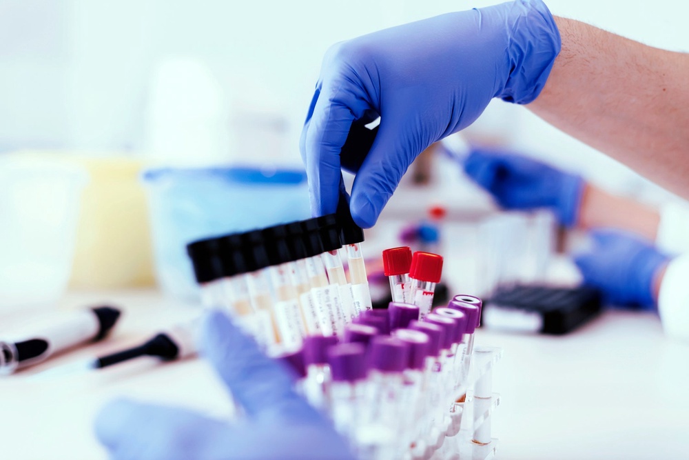 Around 10,900 new bladder cancer cases are diagnosed every year in the UK and are usually diagnosed using a procedure called a cystoscopy (Getty/iStock)
