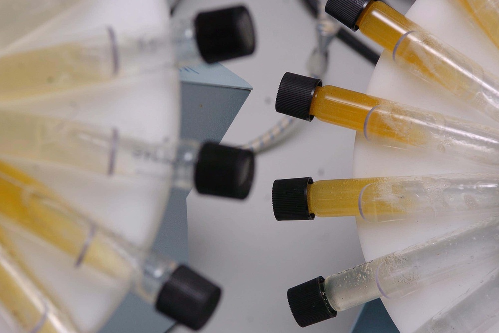 The new urine test can indicate the first possible signs of disease, which could potentially mean cancer could be caught early and enable patients to get treatments sooner. (PA Archive)