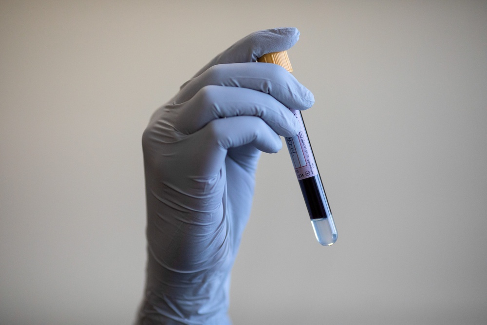 A simple blood test could tell a patient whether they are at low, elevated or high risk of gynaecological cancer (PA Wire)
