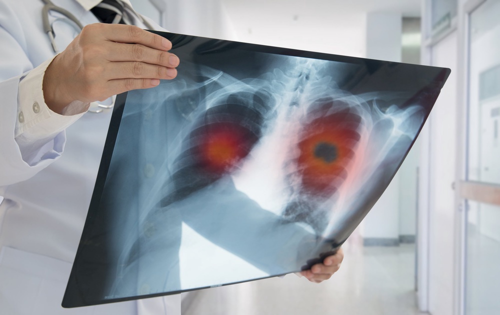 People waiting for lung transplants fear leaving home in case they picked up infections (Getty/iStock)