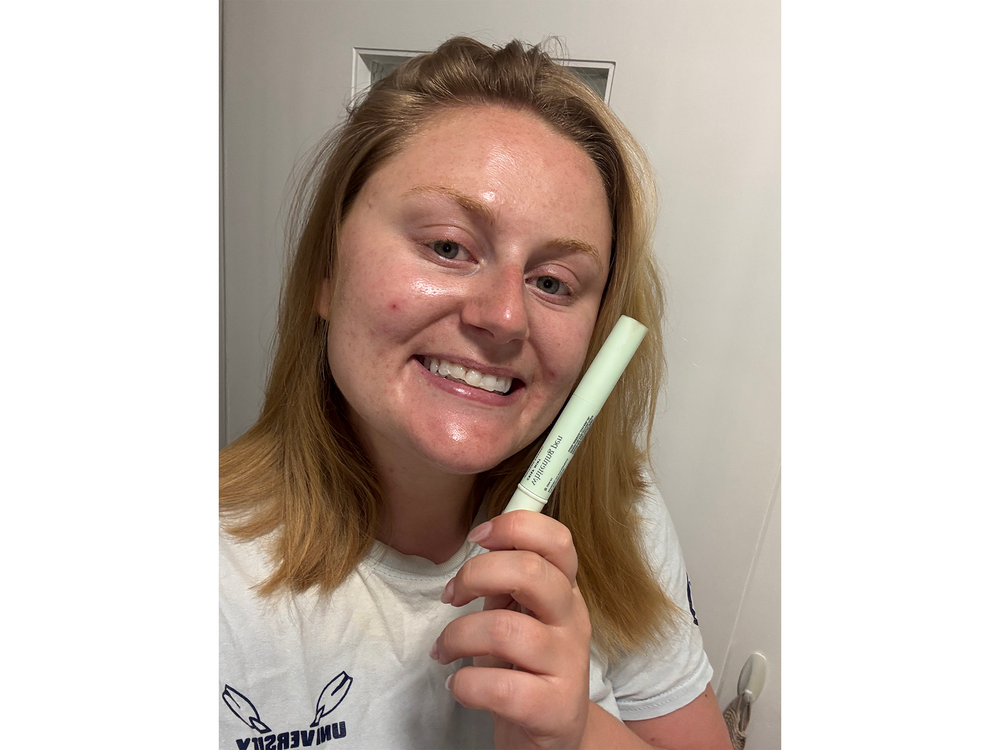 A whitening pen is also included as part of this kit (Lucy Smith/The Independent)