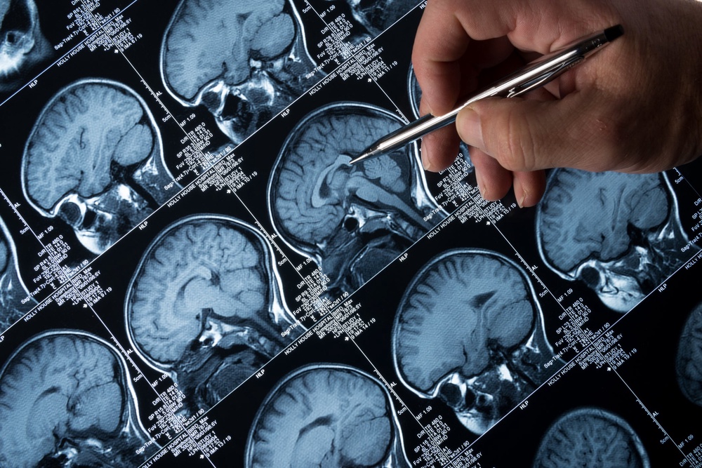 The review also looked at the potential side effects of the drugs, weighing them up with the benefits (Getty/iStock)