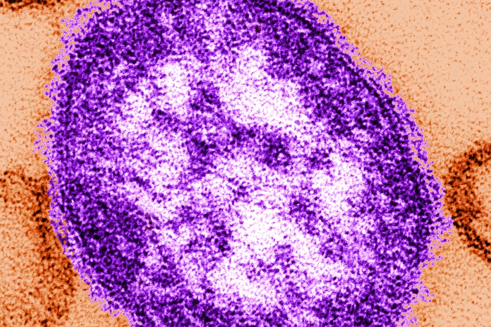 Experts have warned that the uptake of vaccines against measles has stalled in recent years (PA Media)