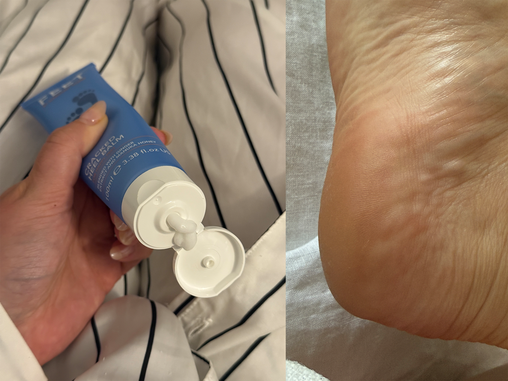 Hairline marks of my cracked heels visibly reduced in depth (Lucy Smith/The Independent)