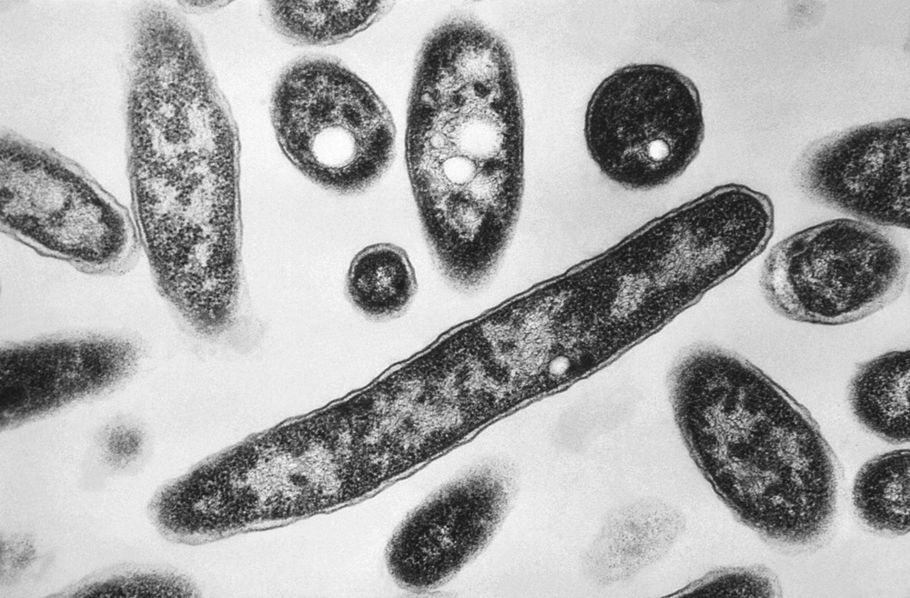 Legionnaires' disease bacteria (CDC)