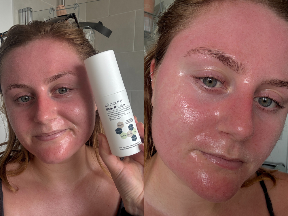 My post-workout redness felt soothed after using the Clinisoothe+ spray (Lucy Smith/The Independent)