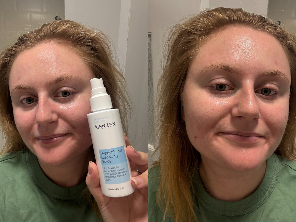 Over time, my skin appeared less greasy (Lucy Smith/The Independent)
