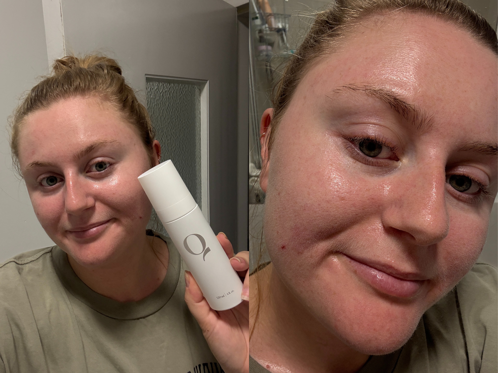 The spray has calming and anti-inflammatory benefits (Lucy Smith/The Independent)