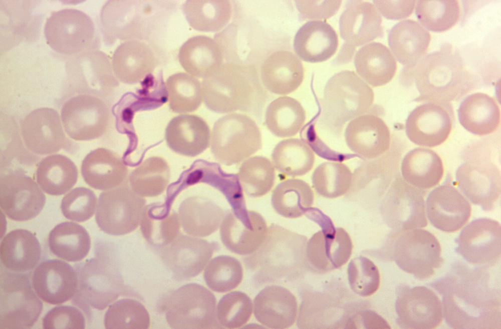 Chagas disease is caused by a parasite which can be carried through the fecal matter of the bugs (Wikimedia Commons)