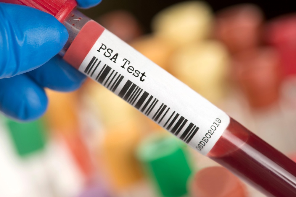A PSA-Prostate specific antigen blood test tube (Alamy/PA)