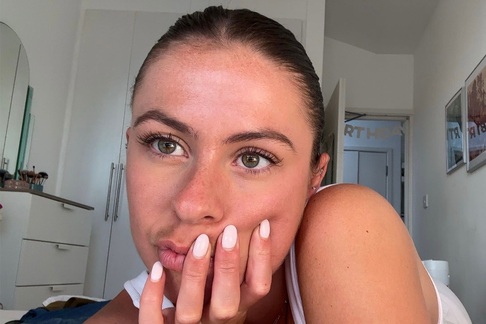 Lydia is one of many young people who’ve had Botox in their twenties (Lydia Spencer-Elliott/The Independent)
