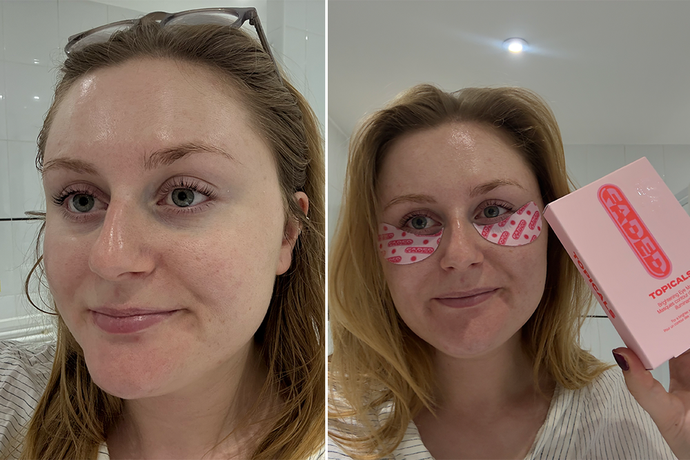 These masks quickly addressed some of my post-inflammatory hyperpigmentation (Lucy Smith/The Independent)