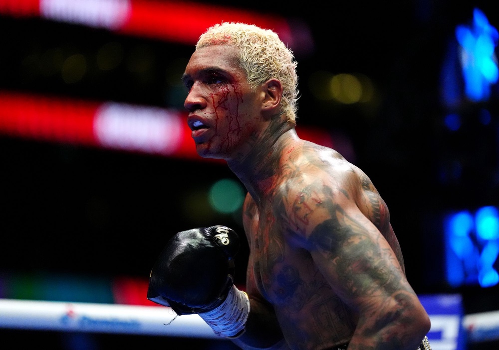 (Bradley Collyer/PA Wire)
