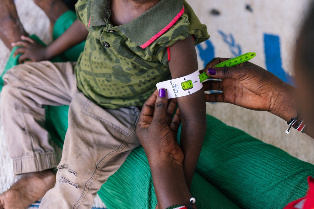 A child's upper arm during a routine home visit to assess for malnutrition inside the Kalobeyei refugee settlement (Sarah Waiswa/British Red Cross)