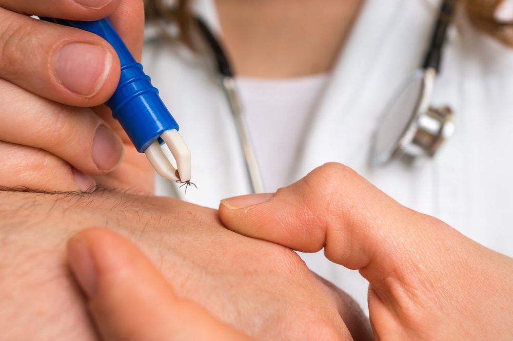 Tick-borne encephalitis (TBE) was considered an “imported disease” to the UK, according to the new report illnesses caused by parasites, viruses and bacteria (Getty/iStock)