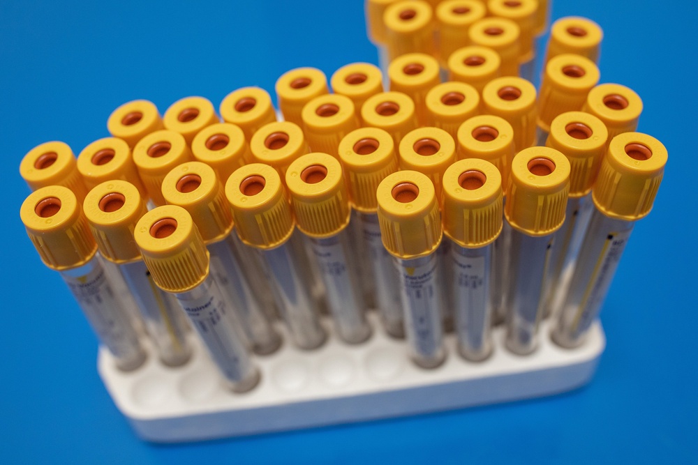 The Biobank has been used to achieve improvements in detection and treatment of dementia, cancers and Parkinson’s (PA) (PA Archive)