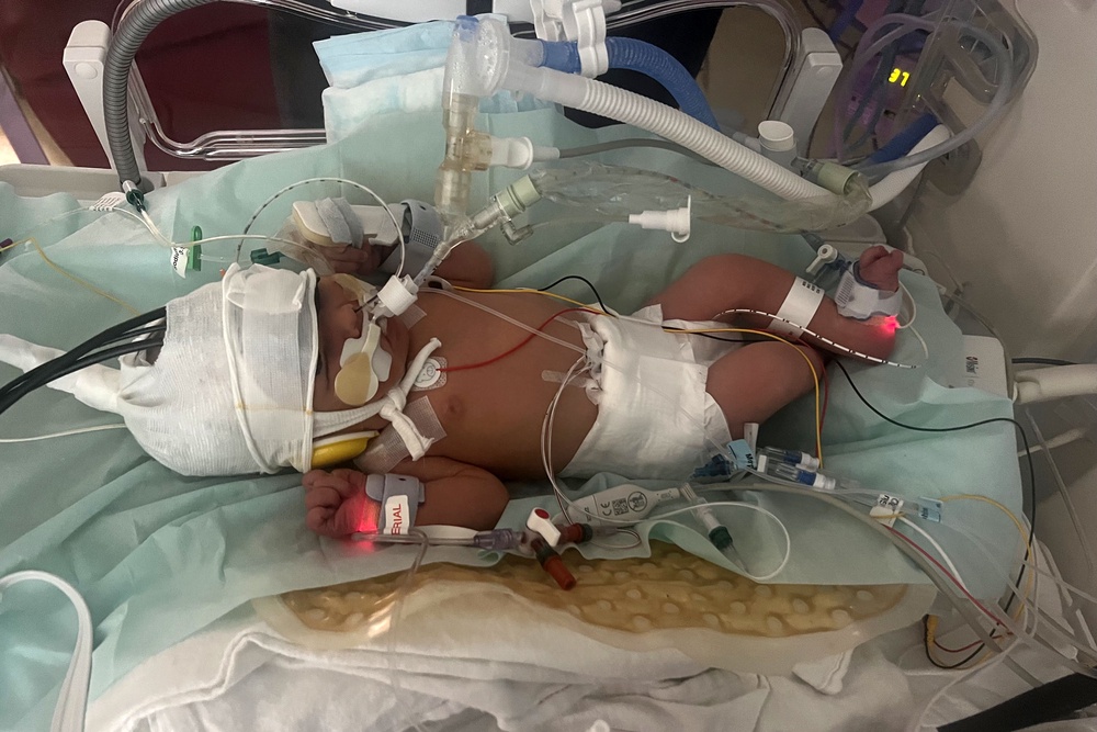 Poppy Hope Lomas’s heart rate slowed down after a contraction (Family handout)